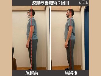 ととのえ処 良久庵/姿勢改善