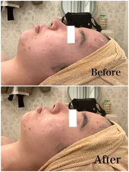 スペチアーレ 夙川/リフトアップ効果抜群