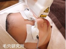 毛穴研究所