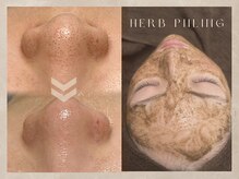 モカラ(MOKARA)の雰囲気（ワックス脱毛・ハーブピーリング・毛穴洗浄・オメガＬＥＤ照射）