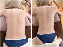 おと(恩智)の雰囲気（１回の施術でむくみがとれ、脇からウエストもスッキリ）