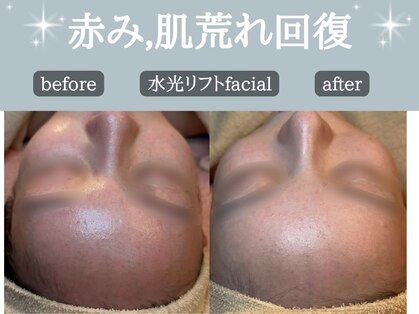 ミトラ(MITRA)の写真