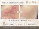 ラヴレボーテ(La Vraie Beaute)の写真/◆岸和田・久米田◆繰り返す肌悩みに終止符を。顧問医師提携で、魅せる素肌へ導く本気の肌改善◆