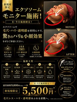 アンテグラールの写真/【期間限定！韓国肌管理☆毛穴ケア、小顔効果抜群】エクソソームモニター施術☆9,800→￥5,500
