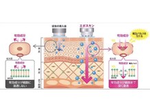 凪 横浜/エレクトロポレーションとは
