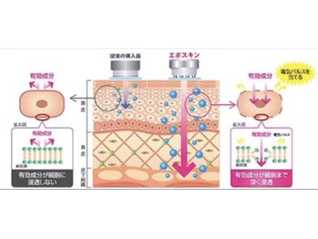凪 横浜/エレクトロポレーションとは