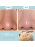 毛穴の奥から徹底洗浄でスッキリ！毛穴引締めパック付11000→¥6800