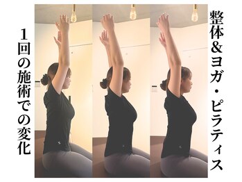 エボニー(Ebony)/1回の施術の効果