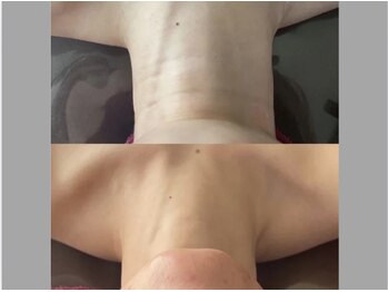 リル シャイン(Rill SHINE)/幹細胞フェイシャル