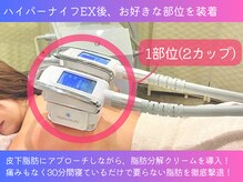 ボディーリセット 勝どき/≪脂肪冷却/勝ちどき≫