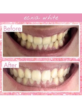 エクシアホワイト 倉吉店(ecxia white)/ビフォーアフター