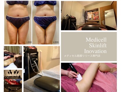 ルリアンデュレ(le lien durer)の写真