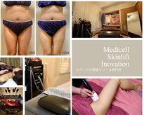 ルリアンデュレ(le lien durer)