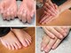 モーダアッカ(moda acca)の写真/《烏丸/四条》巻き爪・深爪が気になる方へ！爪の形を整え、お悩みを改善します♪クーポン多数ご用意☆