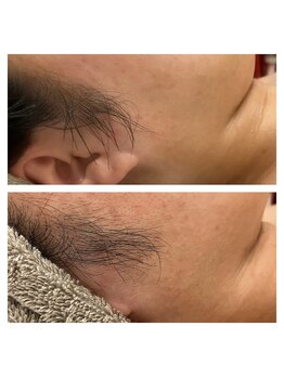 エリー(ERIE)/もみあげもWaxで綺麗に