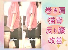 ララスマイル 鶴崎森町店/頭痛 不眠 猫背 首肩こり 整体