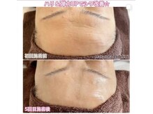 エクレット/【ハリ弾力UP】お客様の変化