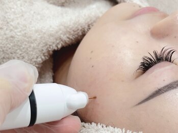 ビップ(vip)の写真/[オリジナルの"シミケア"フェイシャル]大人肌のお悩み解消◎徹底ケアが好評♪肌質改善ですっぴんに自信!!