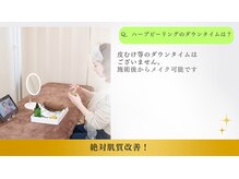 鍼灸院 はりエイト/◇ピーリングのダウンタイムは？