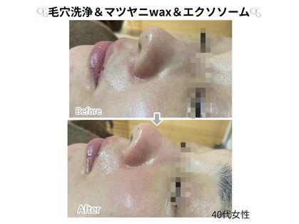 メリナ(Melina)の写真