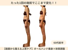 ラルーエ 仙台の雰囲気（【深部筋膜リリース】ファシア×骨格で叶えられる痩身施術）