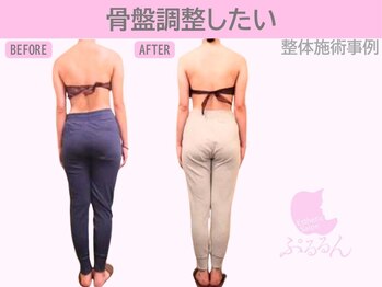 ぷるるんエステ/肩こり/リンパ/骨盤矯正/整体