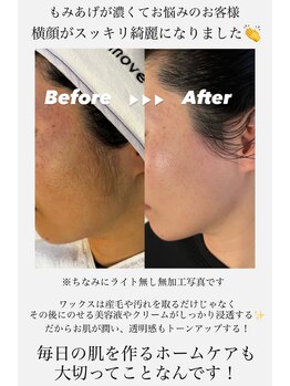 エリス(ELISSE)/もみあげもワックスで綺麗に整う