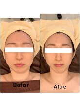 スペチアーレ 夙川/小顔と美肌が手に入る