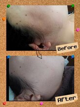 レイジー(Raygee.)/お顔の脱毛もおまかせください♪