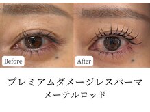 マテオ(Matteo)/SNSで話題のメーテルロッド