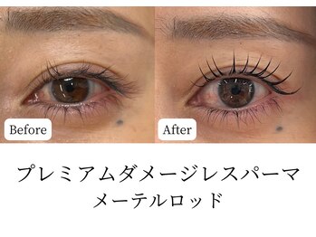 マテオ(Matteo)/SNSで話題のメーテルロッド