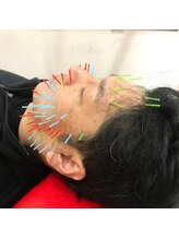 よつば鍼灸整骨院 春日院/美容鍼