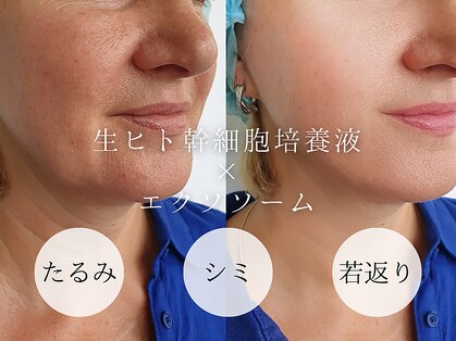 モンダロ(MONDARO)の写真