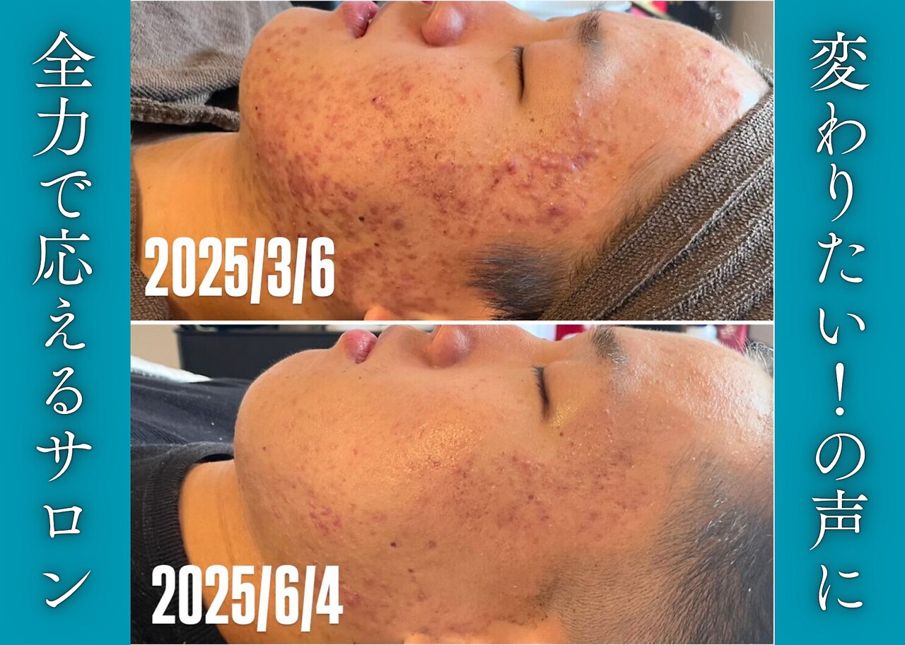 プロテュウス(PUROTUCE)｜ホットペッパービューティー