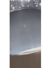 コクーン(COCOON)/ハイドラ施術後の角質写真