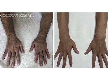 ゴールドプラス 小牧店(GOLD PLUS)/BeforeAfter