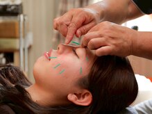 美顔鍼も人気！美肌効果、小顔効果も◎マッサージ付き♪