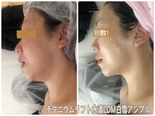 アルページュ(Arpege)