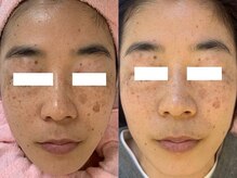 シミケア専門店 SAKURA 平塚店/