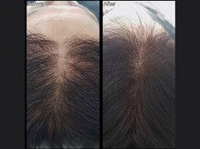 キュライム 熊本(CURAIM)/育毛促進【50代女性】