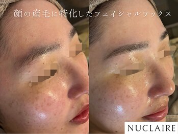 マイミー(My.Me)の写真/【深夜対応エステサロン★】お仕事・寝かしつけ後にすっぴんで通える、女性専用美肌サロン。