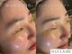 マイミー(My.Me)の写真/【深夜対応エステサロン★】お仕事・寝かしつけ後にすっぴんで通える、女性専用美肌サロン。