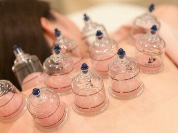 エアーストリーム 前橋店(AIR STREAM)/カッピングで血流改善★