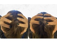 ビーアイリー(Be irie)/フェイシャルエステ直後の変化