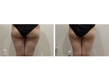 ラナビューティリゾート(Lana Beauty resort)/エステ担当★30代