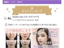 ゴールデンケア(goldencare)の雰囲気（整形級の変化！整形する必要なくなる！コルギとマシン最強コンビ）