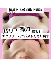 チュベルフェ(tu belle fe)/ヒト臍帯幹細胞◆水光ジェット◆