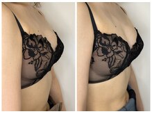 エミナル(EMINARU)/