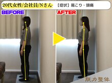 幸せのもり整体院/20代女性/会社員/Nさん