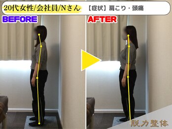 幸せのもり整体院/20代女性/会社員/Nさん